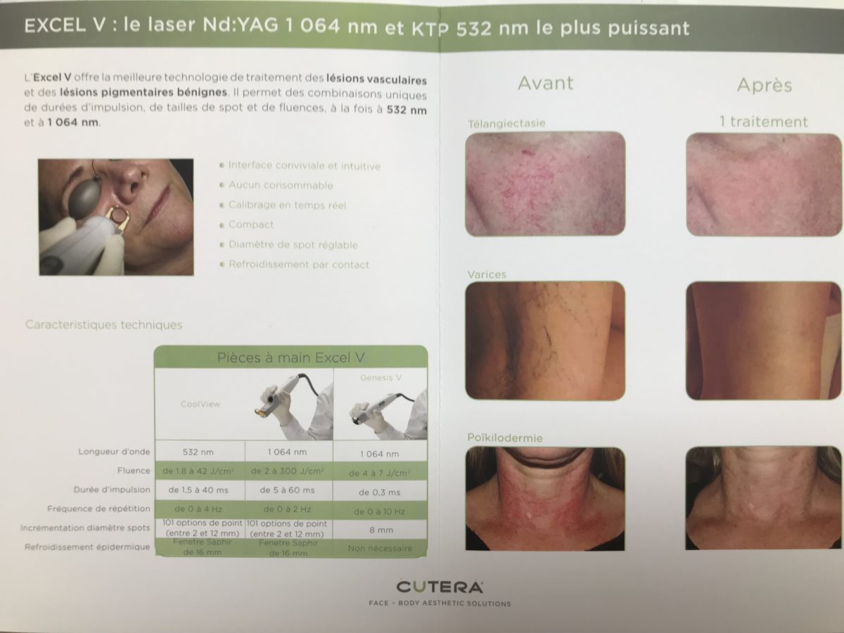 laser vasculaire caen